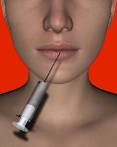 lips, injection, face-2122146.jpg